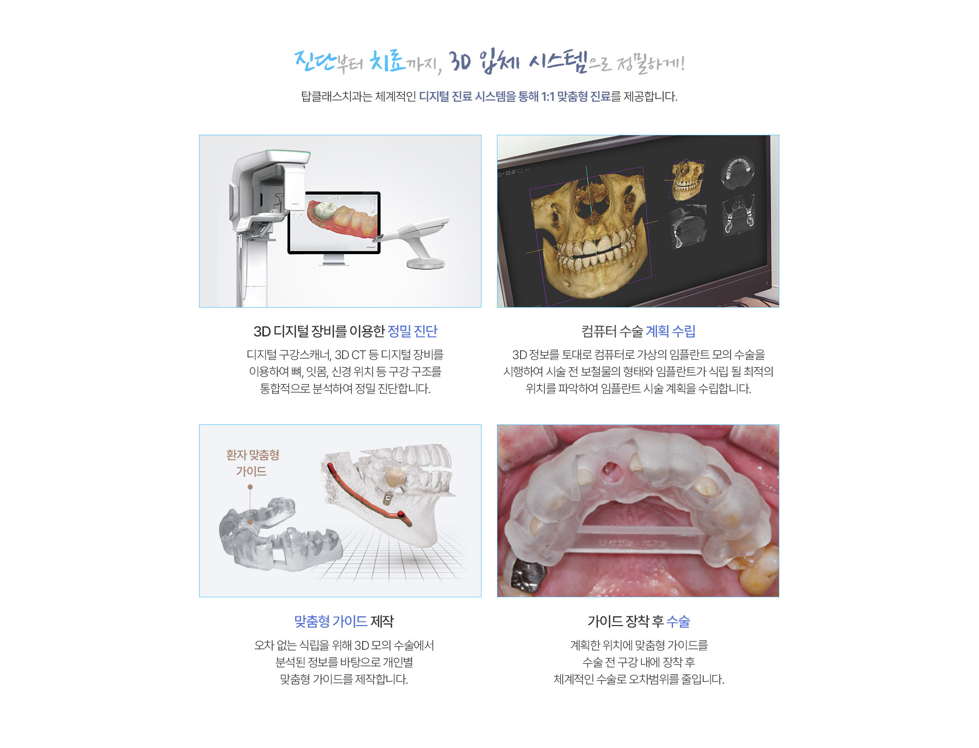 임플란트02