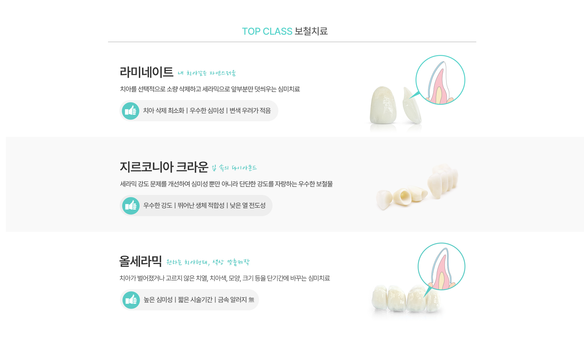 보철치료01