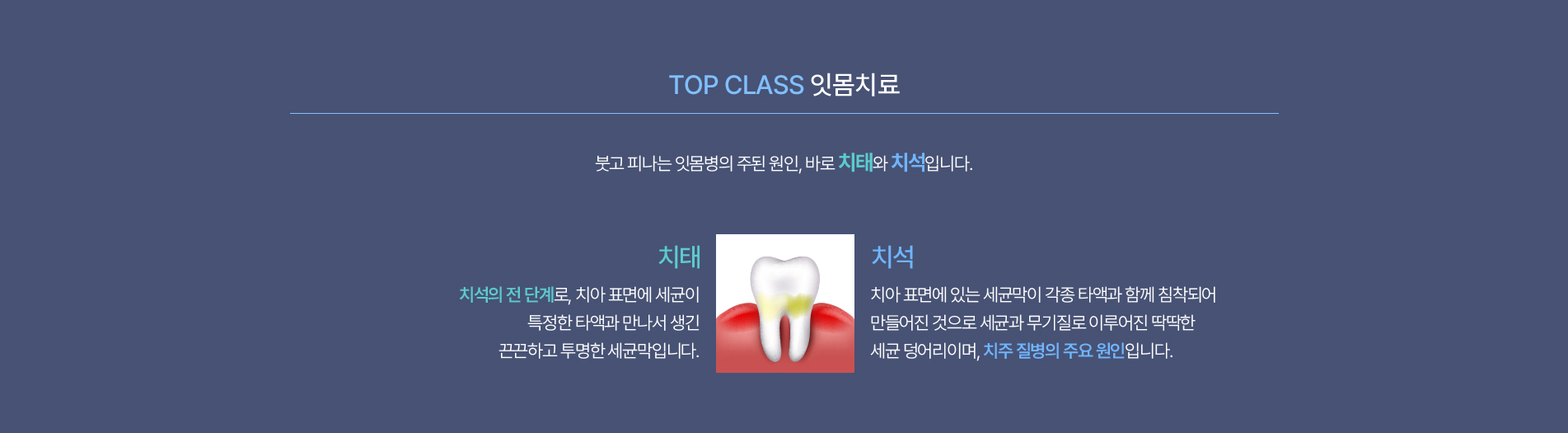 잇몸치료01