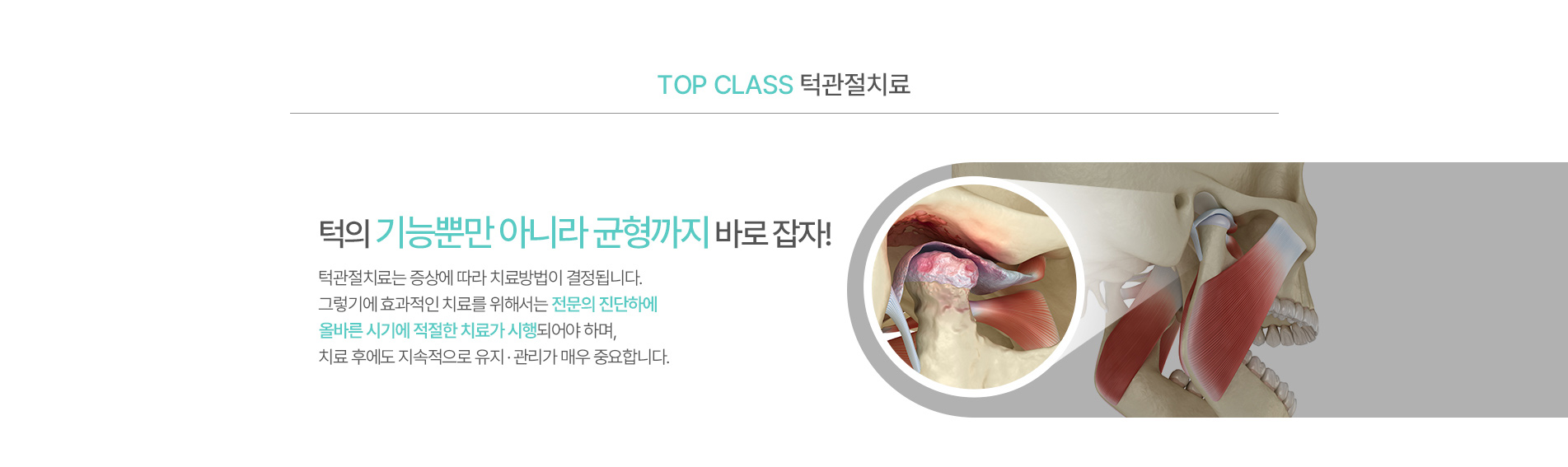 턱관절치료01