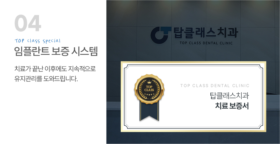임플란트 보증 시스템